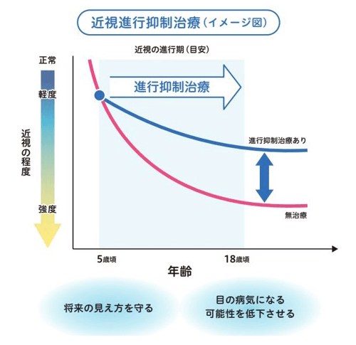 リジュセア点眼治療の効果グラフ(イメージ)